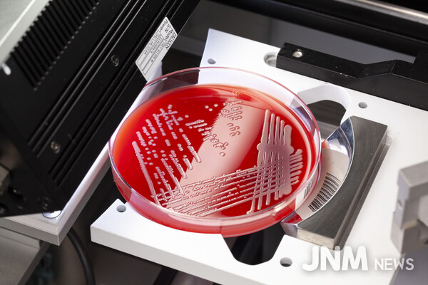 The Copan system captures high-resolution images of culture plates for digital evaluation.